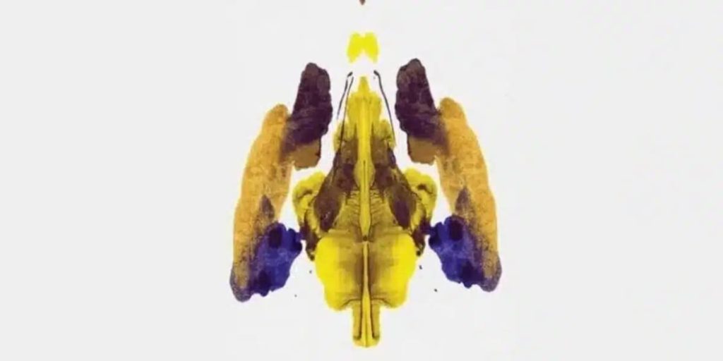 l'image
