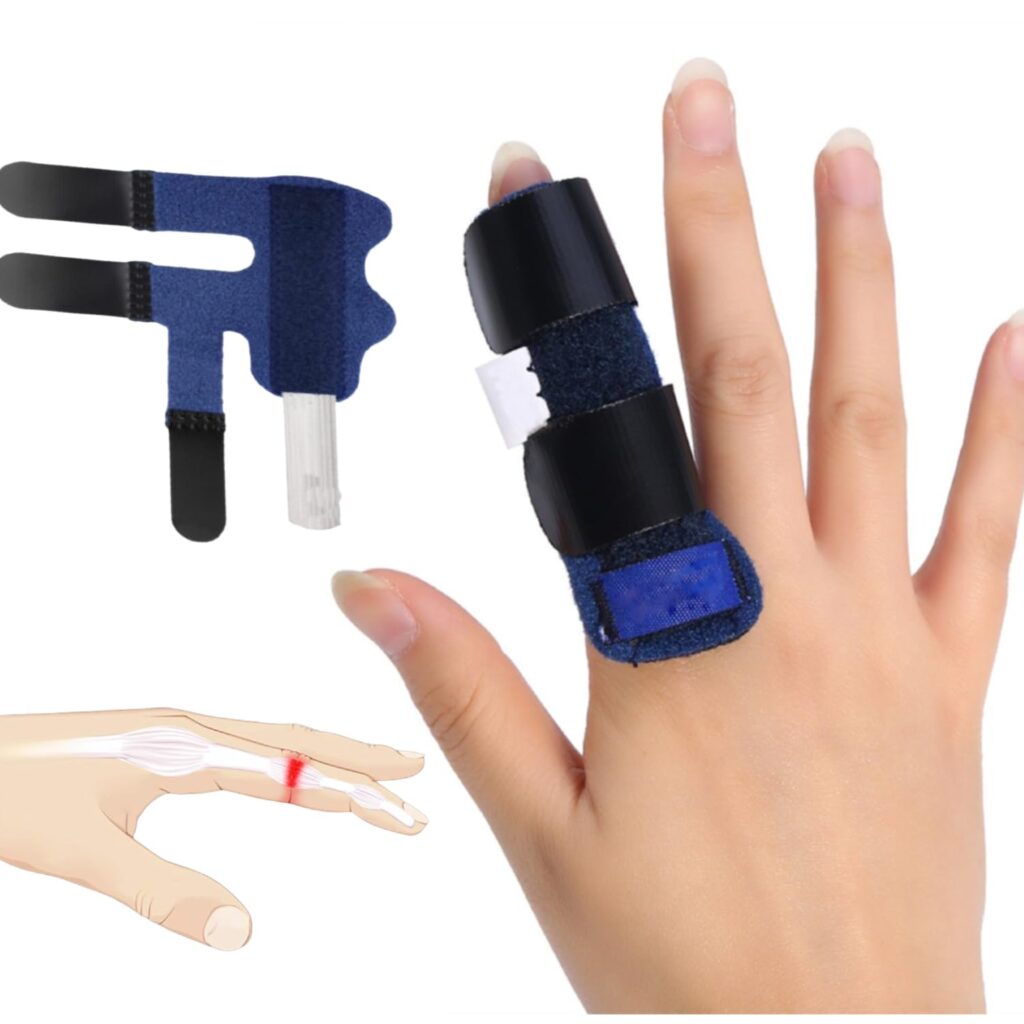 ravailler avec une fracture du doigt 3